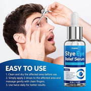 Stye Eye Treatment Serum, Eye Stye Remover for Chalazion, Blepharitis & Stye Removal, Natural Stye Eye Drops, Safe & Fast ...
