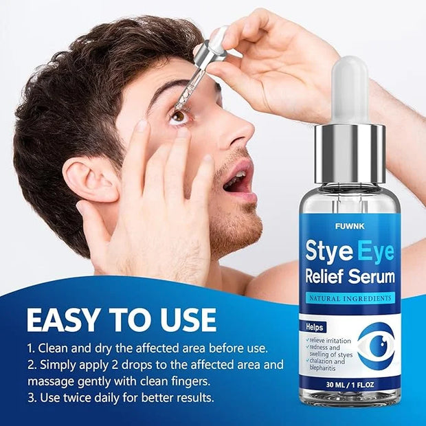 Stye Eye Treatment Serum, Eye Stye Remover for Chalazion, Blepharitis & Stye Removal, Natural Stye Eye Drops, Safe & Fast ...