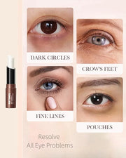 Retinol Eye Stick Under Eye Cream Anti Aging Eye Balm Reduces Fine Lines and Dark Circles - Product Image