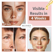 The nordea - 5% Caffeine Serum Angelica - Anti-Aging Eye Serum for Dark Circles, Puffiness and Wrinkles - Caffeine Eye Ser...