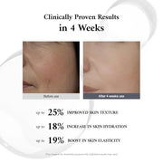 JEU'DEMEURE Collagen, Peptide, Hyaluronic Acid Serum, Face Lift with DermiShuttle, Korean Serum for Anti-Aging, Microneedl...
