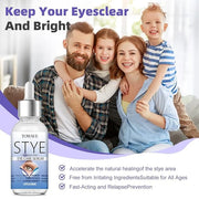Stye Eye Treatment, Natural Relief Drops Serum for Styes Chalazion and Blepharitis, Fast Chalazion Remover for Restore Hea...