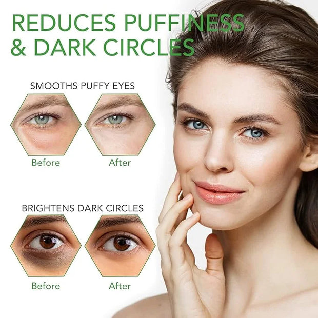 Aloe Veoe Eye Patches,Hydrogel Under Eye Masks for Dark Circles,Anti Wrinkle Treatment,Under Eye Gel Pads,Eye Mask for Puf...