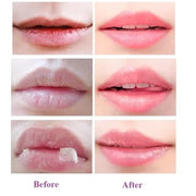 2 Pcs Lip Balm Honey Pot, Balm.