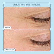 Skinfix Barrier+ Triple Lipid-Boost 360° Eye Cream: Targets Dark Circles, Puffiness, and Fine Lines Around Eyes and Lids, ...