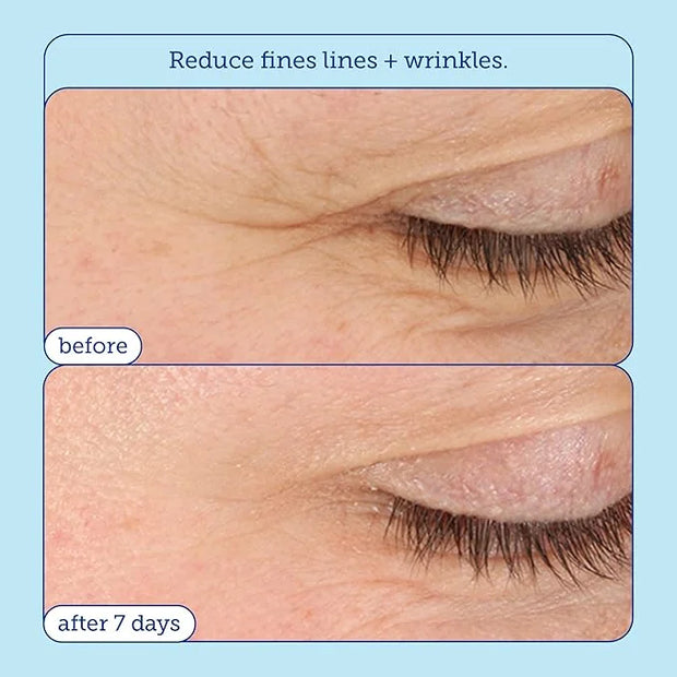 Skinfix Barrier+ Triple Lipid-Boost 360° Eye Cream: Targets Dark Circles, Puffiness, and Fine Lines Around Eyes and Lids, ...