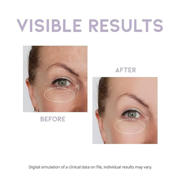 Eye cream for dark circles puffiness and bags anti aging wrinkles korean cream peptide, vitamin c, collagen, vegan under e...