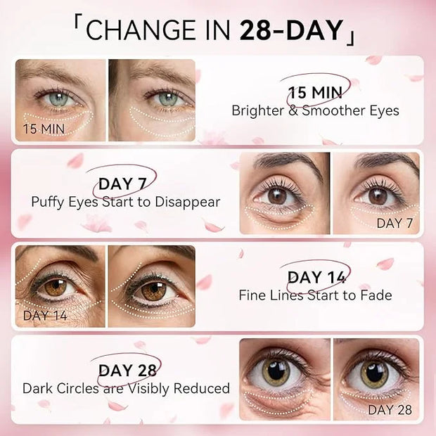 BREYLEE Pink Rose Eye Mask– 60 Pcs - Puffy Eyes and Dark Circles Treatments – Look Younger and Reduce Wrinkles and Fine Li...