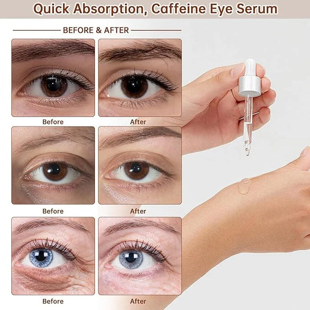 The Caffeine Solution 5% + EGCG，Reduces Appearance of Eye Contour Pigmentation and Puffiness，Under Eye Serum (30ml) Caffei...
