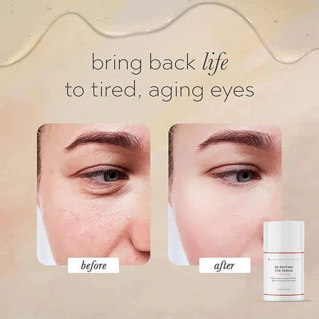 De-Puffing Eye Serum with Caffeine, Aloe Vera, Hyaluronic Acid & Peptides | Reduces Puffiness, Dark Circles, and Fine Line...