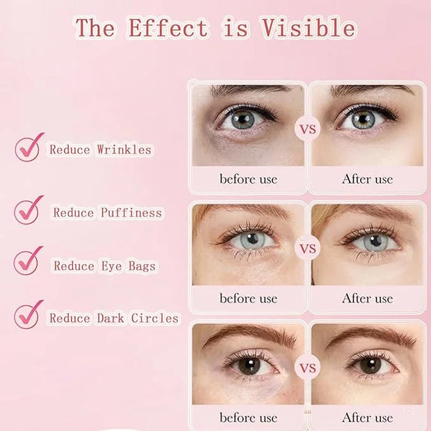 Under Eye Patches, Eye Mask, Reduce Puffy Eyes, Dark Circles, Eye Bags, Eye Patches with Collagen, Anti-Aging Rejuvenating...