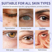Retinol Under Eye Cream for Dark Circles and Under Eye Puffiness, Eye Repair Cream, 2 PCS Anti-Aging Hyaluronic Acid, Coll...