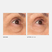 U Beauty The RETURN Eye Concentrate - Anti-Aging Eye Cream with Peptides and Antioxidants for Brighter and Tighter Under E...