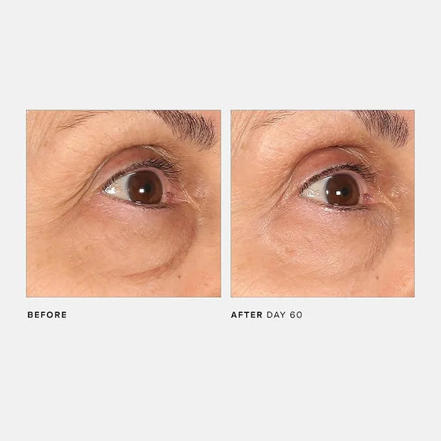 U Beauty The RETURN Eye Concentrate - Anti-Aging Eye Cream with Peptides and Antioxidants for Brighter and Tighter Under E...