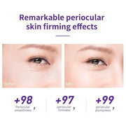 LANBENA Under Eye Cream, Retinol Eye Cream for Dark Circles and Puffiness, Daily Anti-Aging Under Eye Cream with Retinol &...