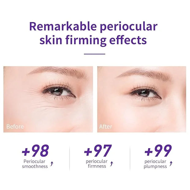LANBENA Under Eye Cream, Retinol Eye Cream for Dark Circles and Puffiness, Daily Anti-Aging Under Eye Cream with Retinol &...