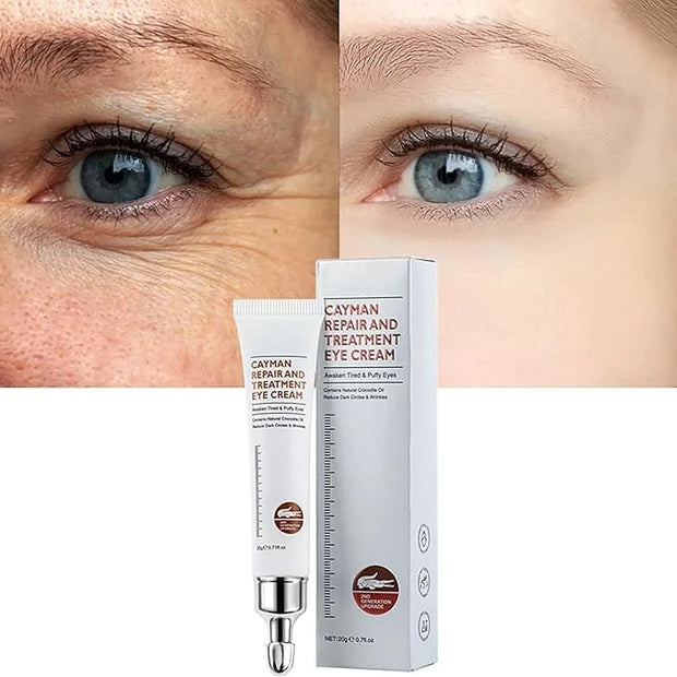 Magic Eye Cream, Instantly Remove Under Eye Bags Wrinkles Puffiness Dark Circles and Fine Lines, Anti Aging Eye Cream for ...
