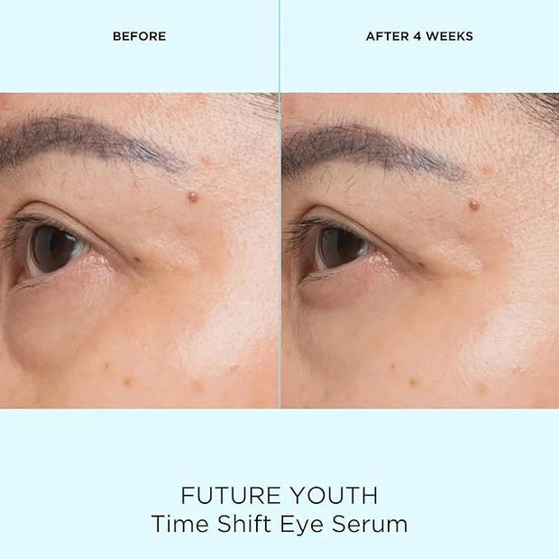 Pacifica Future Youth Time Shift Eye Serum – Peptide Eye Serum for Fine Lines & Dark Circles, Lifting & Firming Under Eye ...