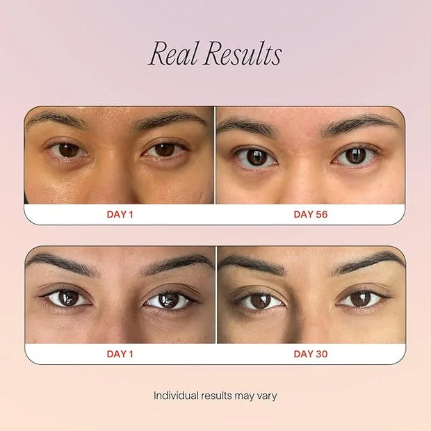 Solawave Eye Recovery Pro Kit | Red Light Therapy Eye Mask + LightBoost Eye Cream | Reduce Fine Lines & Wrinkles, Under Ey...