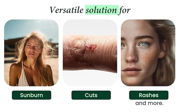 100% Pure & Organic Aloe Vera Spray, Clinically tested & Dermatologist approved, Hydrates & Heals Dry & Damaged Skin & Hai...