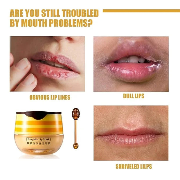 2 Pcs Lip Balm Honey Pot, Lip.