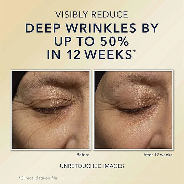 RoC Retinol Correxion Deep Wrinkle Night Cream 1.0 fl oz (30 ml) - Product Image