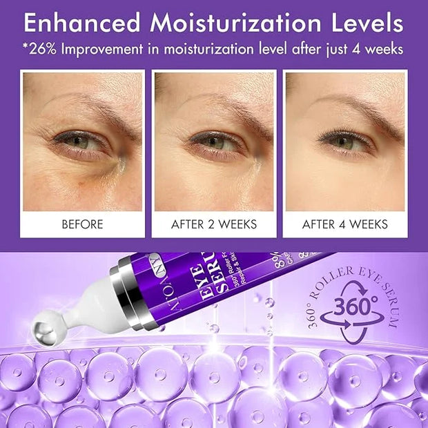 Eye Treatment Serum - 8% Caffeine & Retinol, Hyaluronic Acid, Niacinamide, Peptides - Cream for Dark Circles, Puffy Eyes, ...