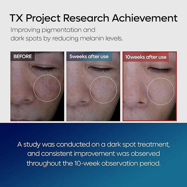TX Tranexamic Acid Care Line TX cream+Toner+Ampoule+Cleanser Powerful Dark Spot Care | Visible Improvement in 4-8 Weeks - ...