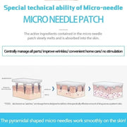 2 Pack Dissolving Microdart Eye Patches with Hyaluronic Acid & Peptides - Target Fine Lines & Wrinkles, Hydrate & Rejuvena...