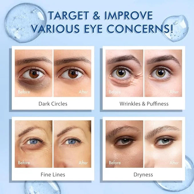 Advanced Eye Serum with Caffeine & Retinol,Eye Treatment Cream for Dark Circles Under,Anti Aging Eye Serum with 360°Massag...