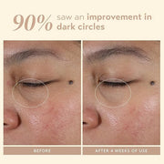 SHANI DARDEN SKIN CARE Intensive Eye Renewal Cream, Anti-Aging Eye Cream for Fine Lines, Crow’s Feet and Dark Circles, Cre...