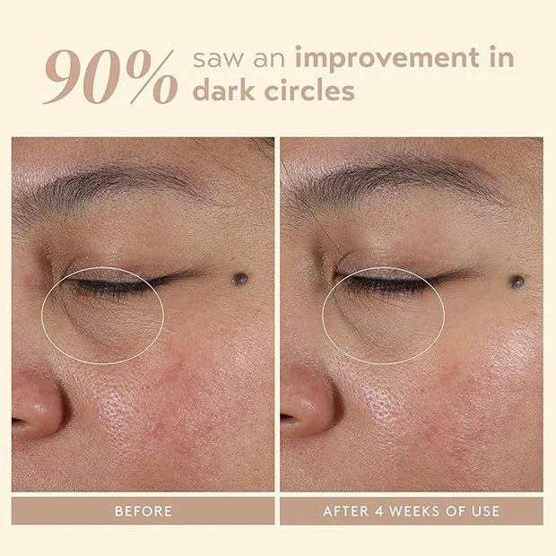 SHANI DARDEN SKIN CARE Intensive Eye Renewal Cream, Anti-Aging Eye Cream for Fine Lines, Crow’s Feet and Dark Circles, Cre...