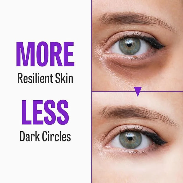 Time Return Melatonin Eye Cream for Dark Circles & Fine Lines | Clarifying Eye Cream for Bags Under Eyes | Firming Eye Cre...