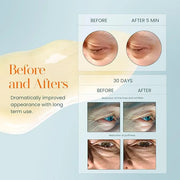Hylunia Intensive Repair Eye Cream – Hydrating & Firming with Peptides, Vitamin C & Hyaluronic Acid – Reduces Dark Circles...