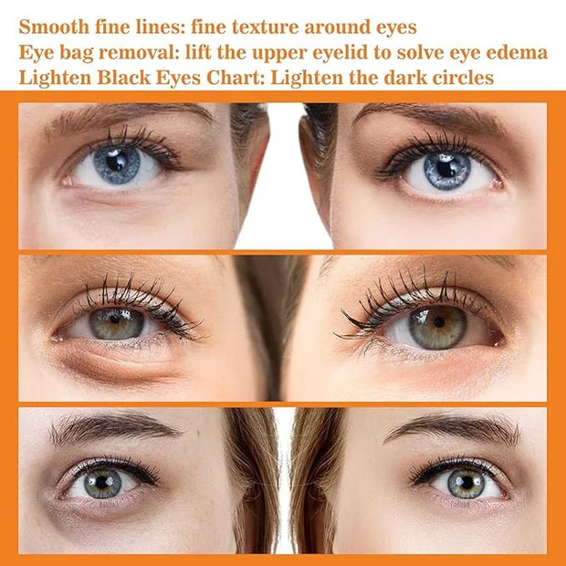 Turmeric + Vitamin C Booster Eye Cream, Brightening and Hydrating Eye Cream, Dark Circle Relief, Elasticity Treatment, Gen...