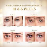 VELAMO ADVANCED Under Eye Patches: 24K Gold Under Eye Mask for Puffy - Retinol Patchology Eye Patches for Wrinkles and Dar...