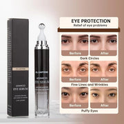 Caffeine Eye Cream for Puffiness & Dark Circles, Under Eye Cream for Puffy Eyes, Eye Bags & Wrinkles, 1 PCS Anti Aging Eye...