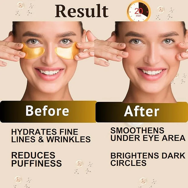 24K Gold Under Eye Patches (20 Pairs) Anti-Aging, Hydrating, Depuffing, Dark Circles, Wrinkles, Collagen & Hyaluronic Acid...