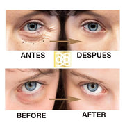 24K ULTIMATE Eye Care Set - Luxurious Anti-Aging Masks & Serum - Effective Under Eye Treatment for Puffiness, Dark Circles...