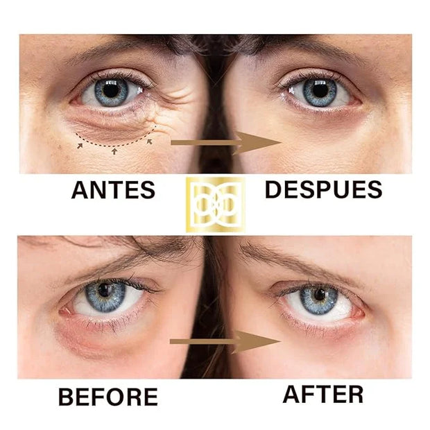 24K ULTIMATE Eye Care Set - Luxurious Anti-Aging Masks & Serum - Effective Under Eye Treatment for Puffiness, Dark Circles...