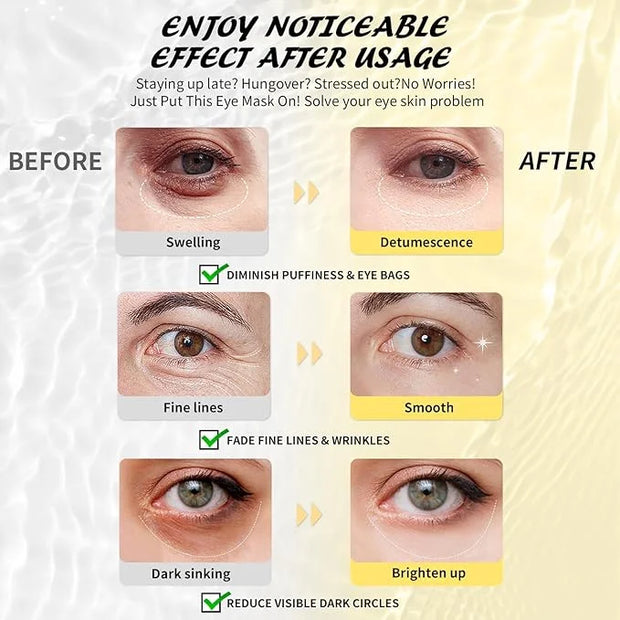 Under Eye Patches(8 Pairs), 24K Gold, Caffeine, Hyaluronic Acid, Aloe Vera Eye Masks for Dark Circles Puffy Eyes Undereye ...