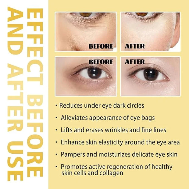 Eye Roller for Puffy Eyes, Castor Oil and Frankincense Eye Roller for Dark Circles, and Wrinkles, Anti Aging Eye Serum Cre...