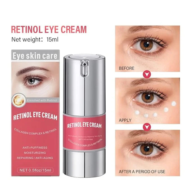 Retinol eye cream for dark
