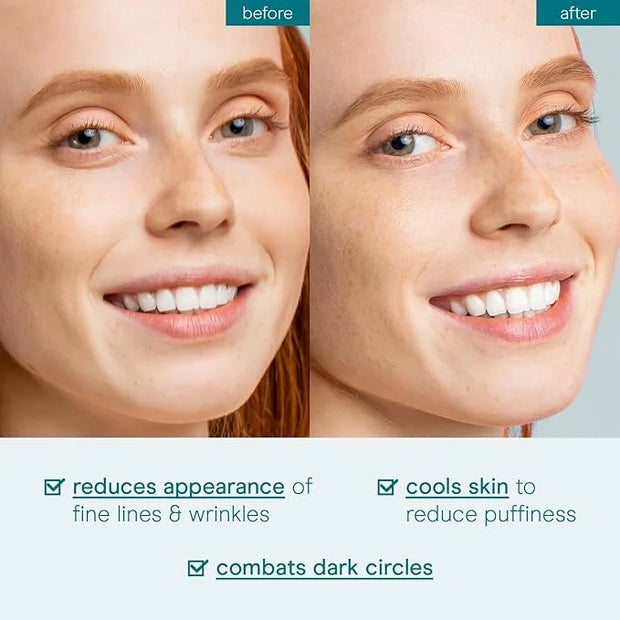 Baebody Critically Acclaimed Eye Gel - Advanced Cooling Under Eye Cream For Dark Circles and Puffiness - Anti Aging and Hy...