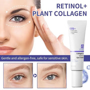 Retinol Under Eye Cream for Dark Circles and Under Eye Puffiness, Eye Repair Cream, 2 PCS Anti-Aging Hyaluronic Acid, Coll...
