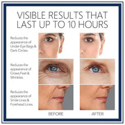 Rapid Reduction Eye Serum - Visibly Reduces Under-Eye Bags, Wrinkles, Dark Circles, Fine Lines & Crow's Feet Instantly, An...