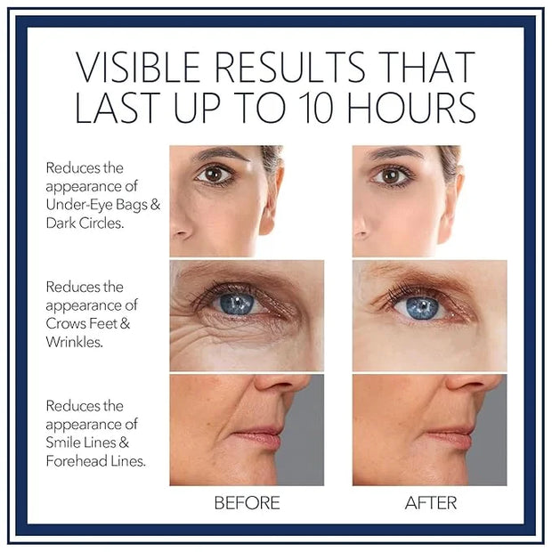 Rapid Reduction Eye Serum - Visibly Reduces Under-Eye Bags, Wrinkles, Dark Circles, Fine Lines & Crow's Feet Instantly, An...