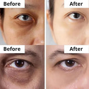 DermaSet Eye Serum with Caffeine and Vitamin C to Improve Fine Line and Dark Circles | 0.51 Fl Oz (Pack of 1) - Product Image