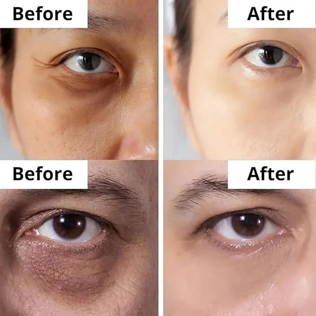DermaSet Eye Serum with Caffeine and Vitamin C to Improve Fine Line and Dark Circles | 0.51 Fl Oz (Pack of 1) - Product Image