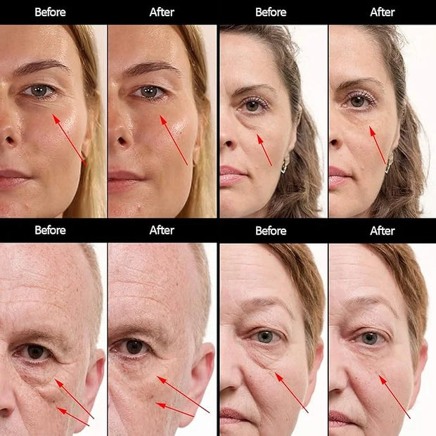 Puffy Eye Treatment Instant results – Naturally Eliminate Wrinkles, Puffiness, Dark Circle and Bags in Minutes – Hydrating...